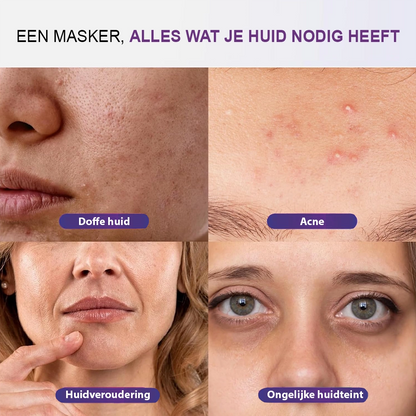 LED Masker – Gezichtsmasker Lichttherapie met 7 Modi & NIR Licht