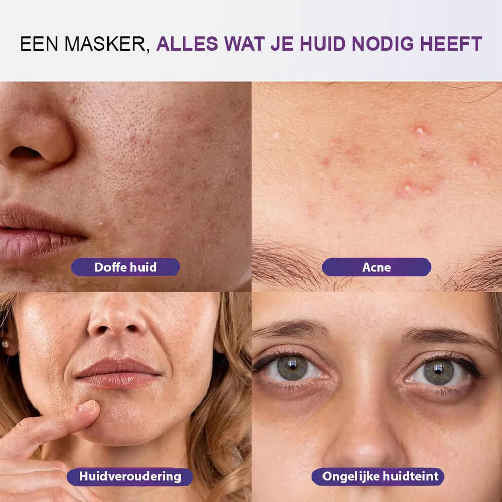 led-masker-acne-huidveroudering-egale-huid