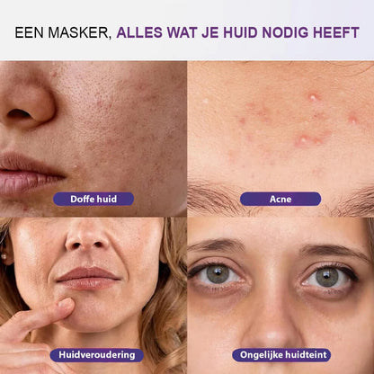 led-masker-acne-huidveroudering-egale-huid