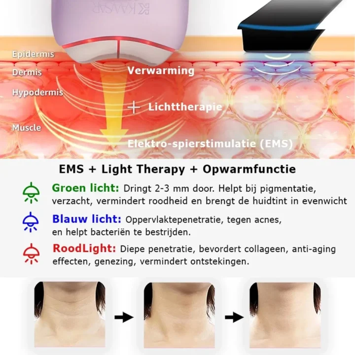 Premium EMS Gua Sha | Huidverzorgings & Beauty tool met Lichttherapie - Afbeelding 4